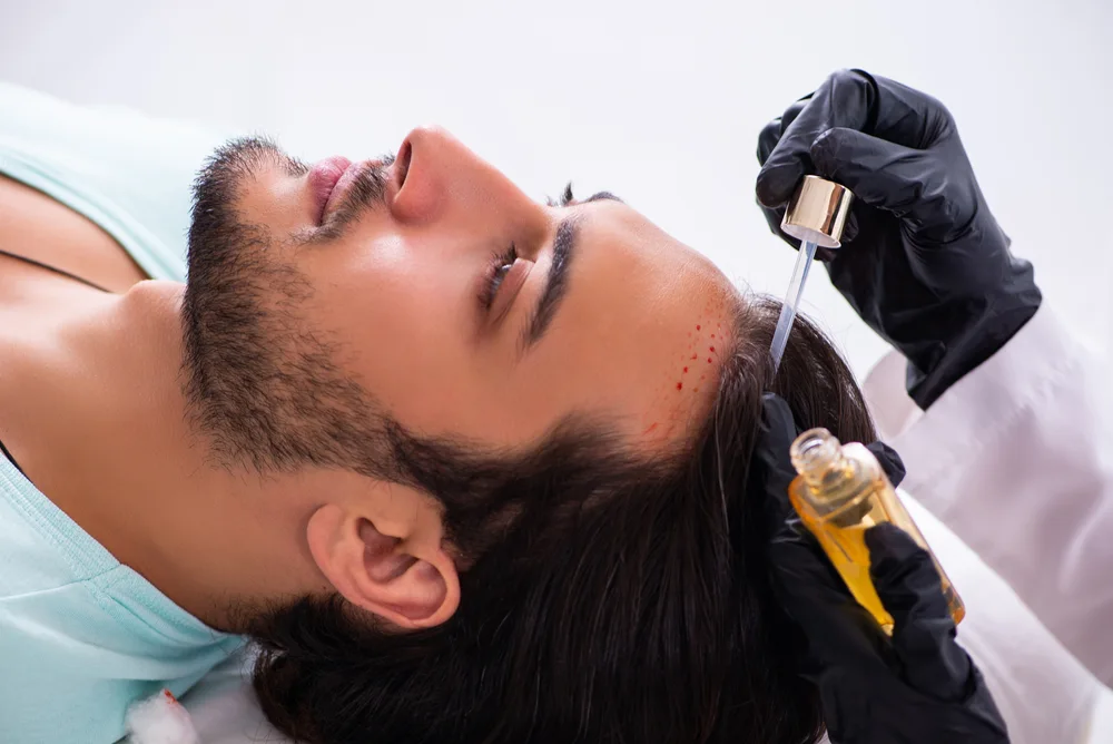 Hair Transplant
